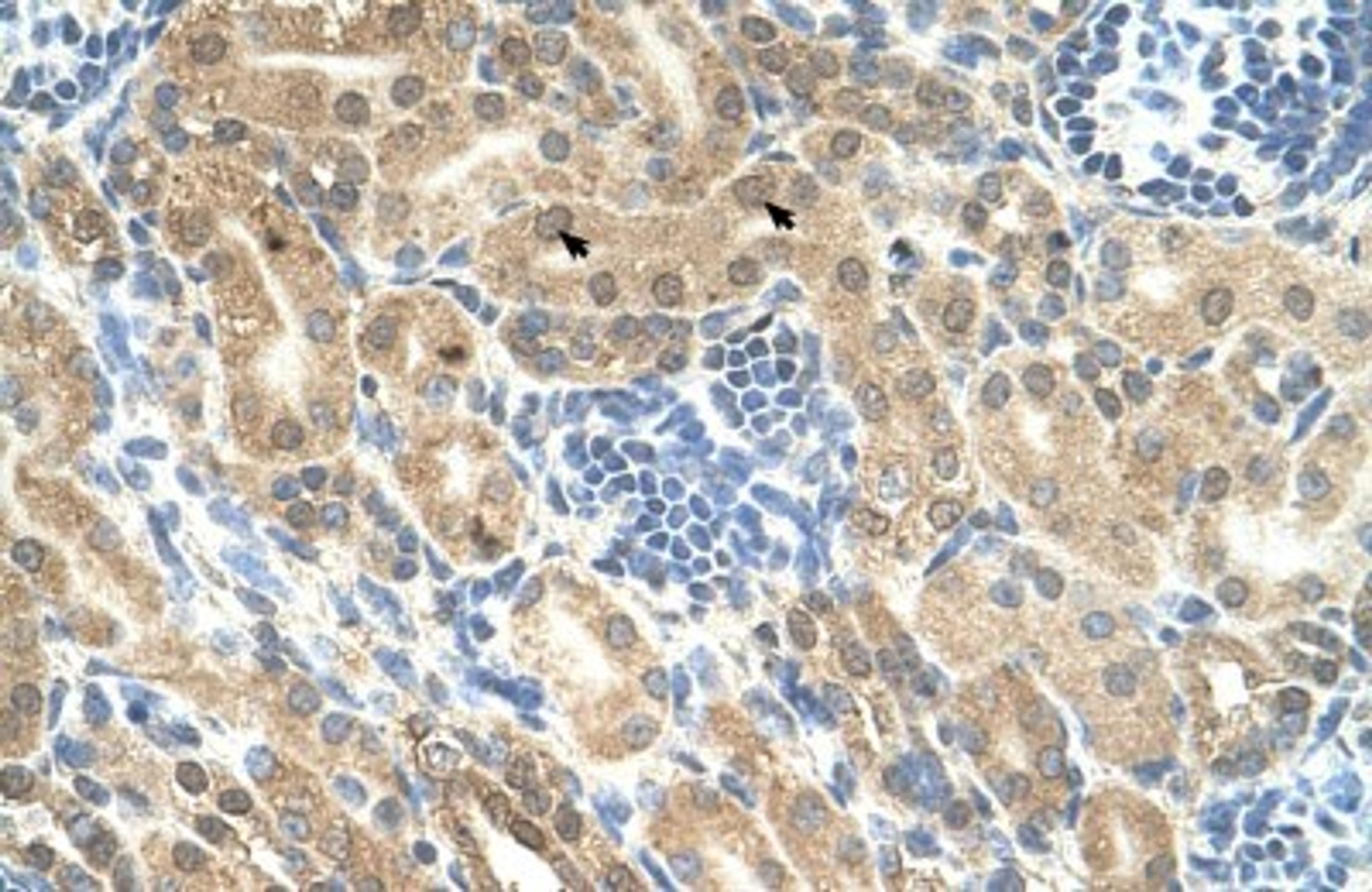 Immunohistochemistry-Paraffin: Indian Hedgehog/Ihh Antibody [NBP1-59443] - Human kidney Tissue, antibody concentration 4-8ug/ml. Cells with positive label: renal corpuscle cells (indicated with arrows) 400X magnification.