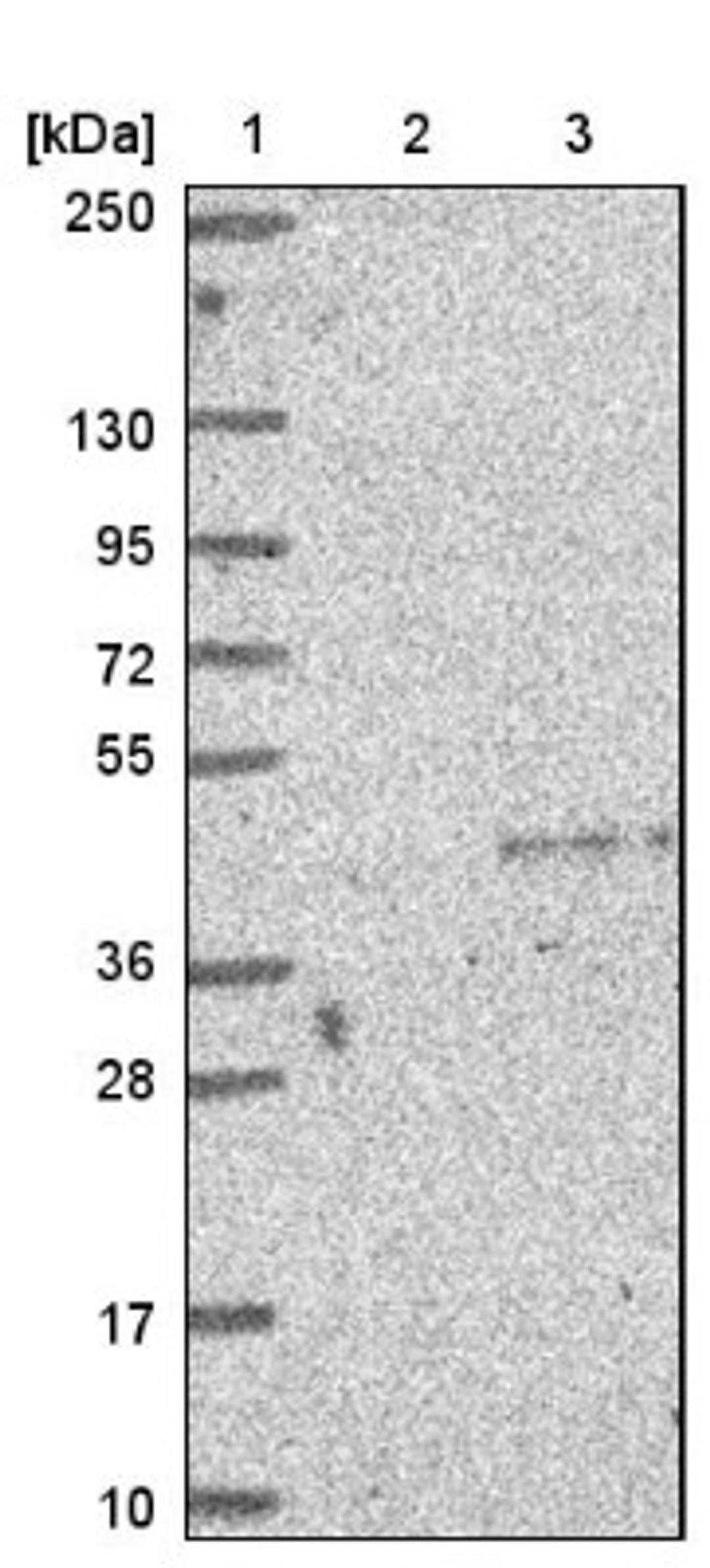 Western Blot: CORD2 Antibody [NBP1-88059] - Lane 1: Marker [kDa] 250, 130, 95, 72, 55, 36, 28, 17, 10<br/>Lane 2: Negative control (vector only transfected HEK293T lysate)<br/>Lane 3: Over-expression lysate (Co-expressed with a C-terminal myc-DDK tag (~3.1 kDa) in mammalian HEK293T cells, LY424645)