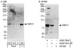 Detection of human FBP17 by western blot and immunoprecipitation.