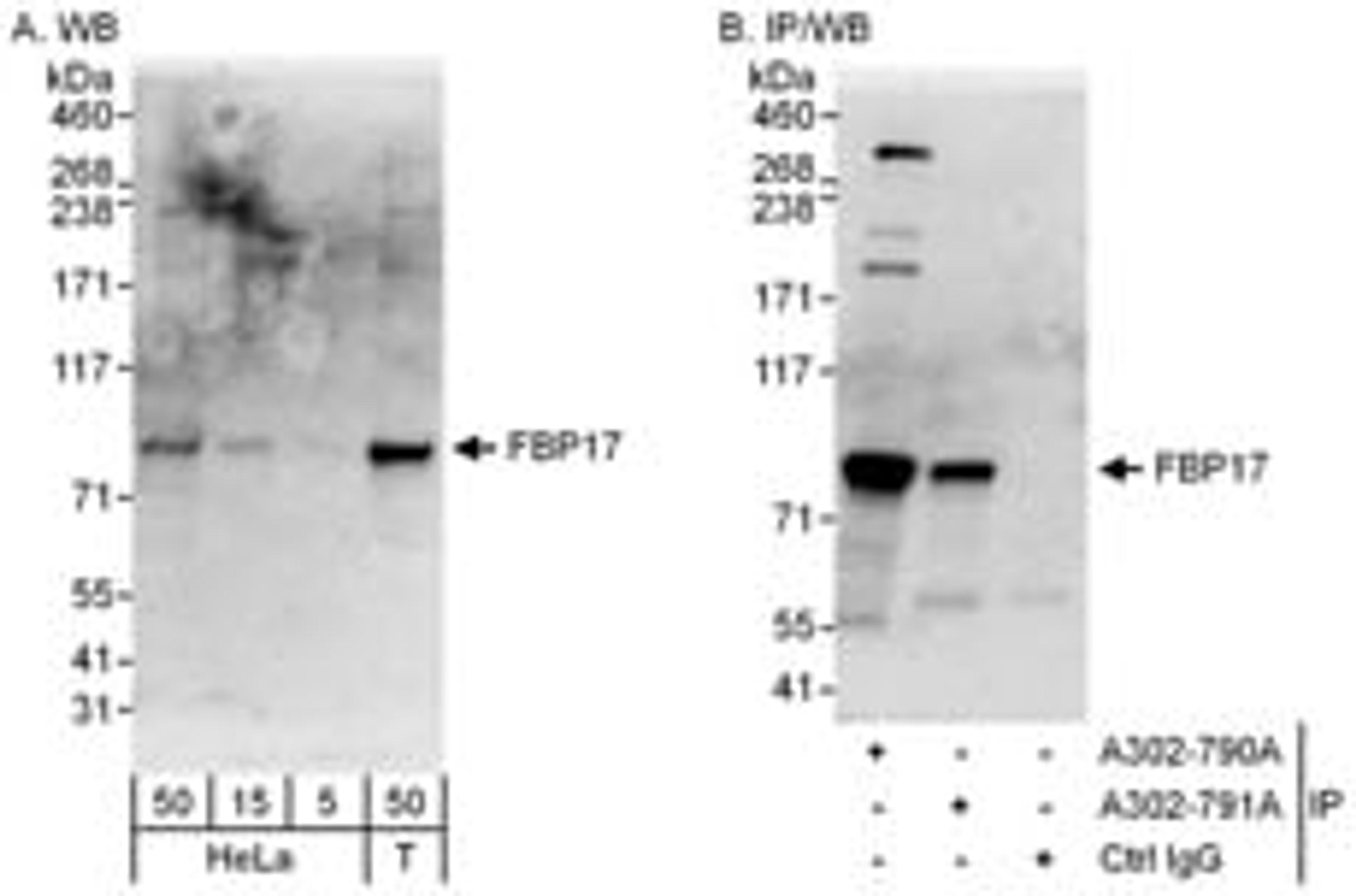 Detection of human FBP17 by western blot and immunoprecipitation.