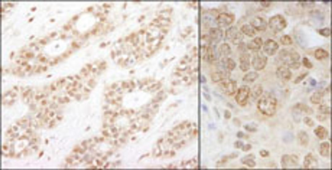 Detection of human and mouse IKK-alpha by immunohistochemistry.