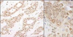 Detection of human and mouse IKK-alpha by immunohistochemistry.