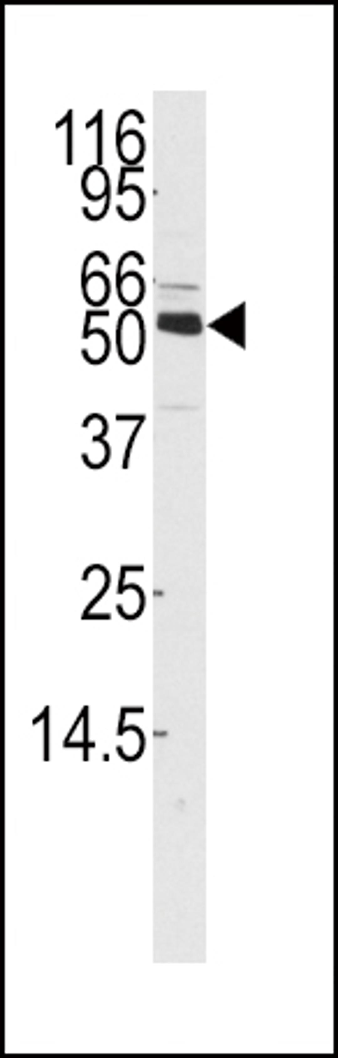 Western blot analysis of anti-CAMKK1 Antibody in mouse thymus tissue lysates (35ug/lane)