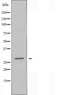 Western blot analysis of RAW264.7 cells using HOXA11/D11 antibody