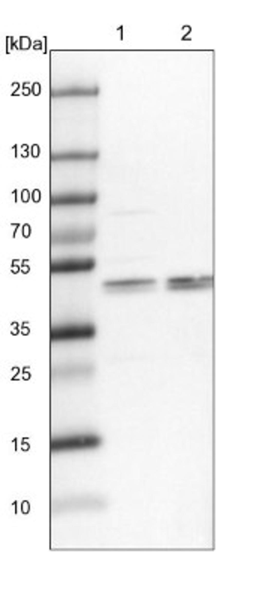 Western Blot: KRR1 Antibody [NBP1-92060] - Lane 1: NIH-3T3 cell lysate (Mouse embryonic fibroblast cells)<br/>Lane 2: NBT-II cell lysate (Rat Wistar bladder tumour cells)