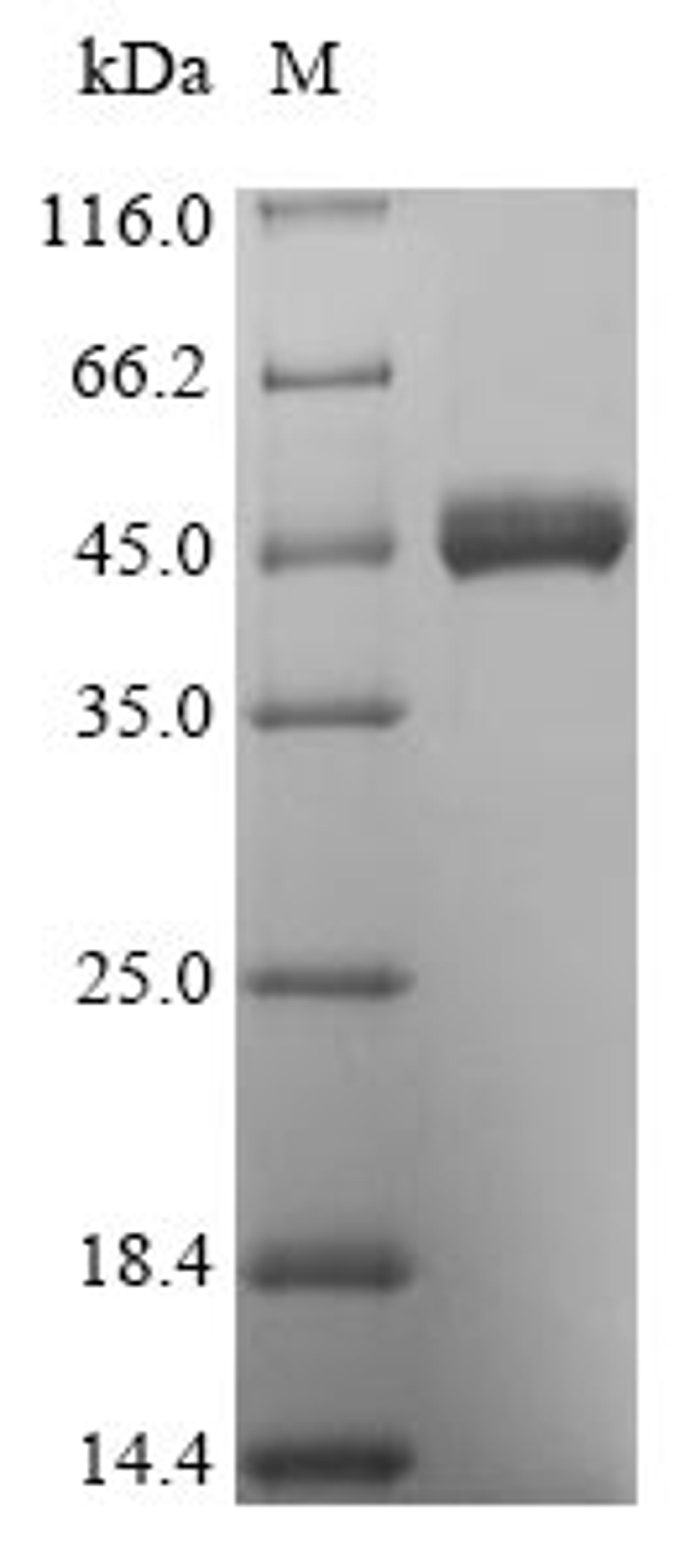 (Tris-Glycine gel) Discontinuous SDS-PAGE (reduced) with 5% enrichment gel and 15% separation gel.