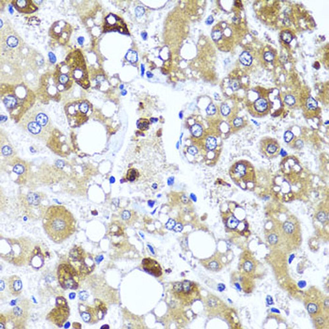 Immunohistochemistry - IL4 antibody (A5649)