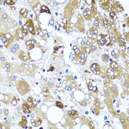 Immunohistochemistry - IL4 antibody (A5649)