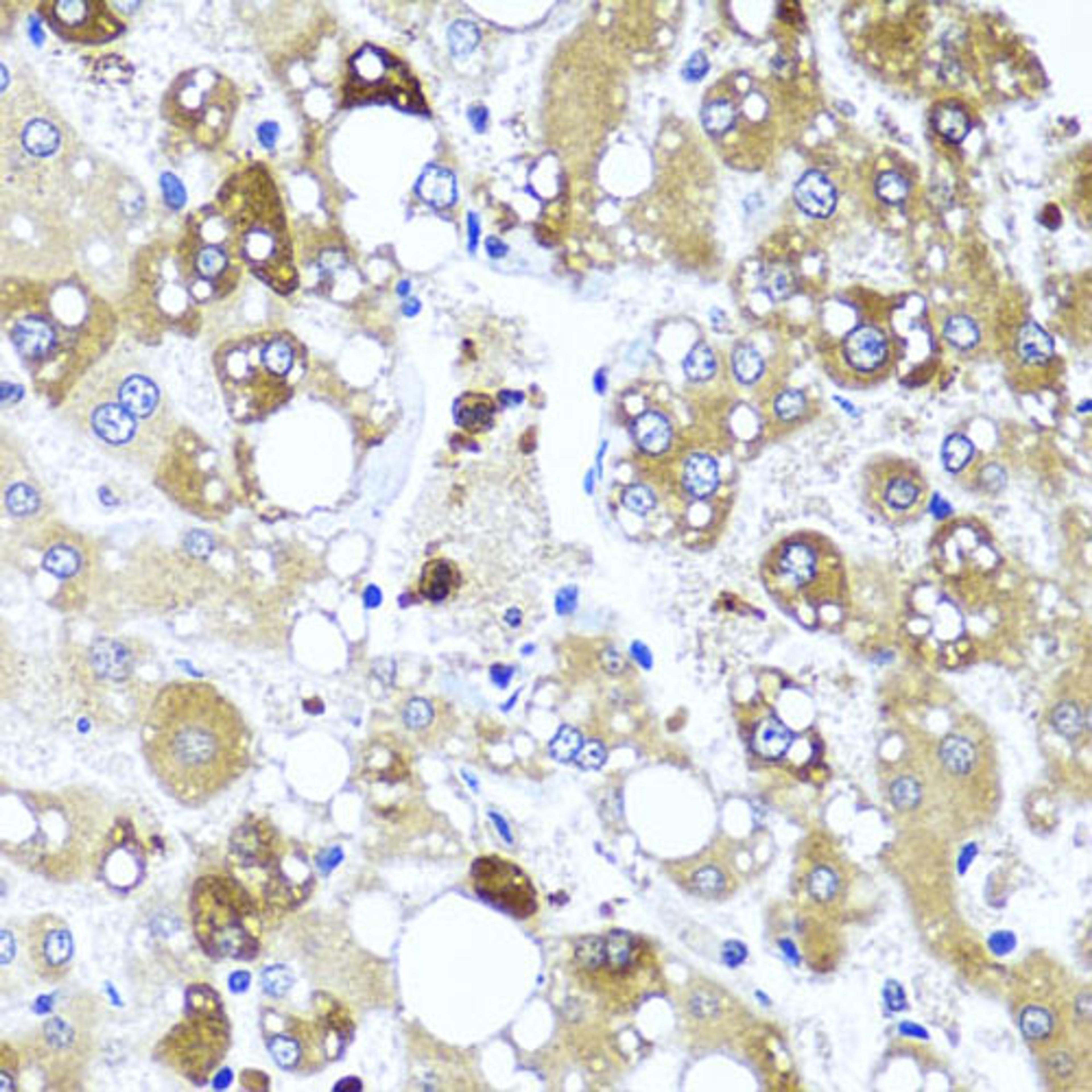 Immunohistochemistry - IL4 antibody (A5649)