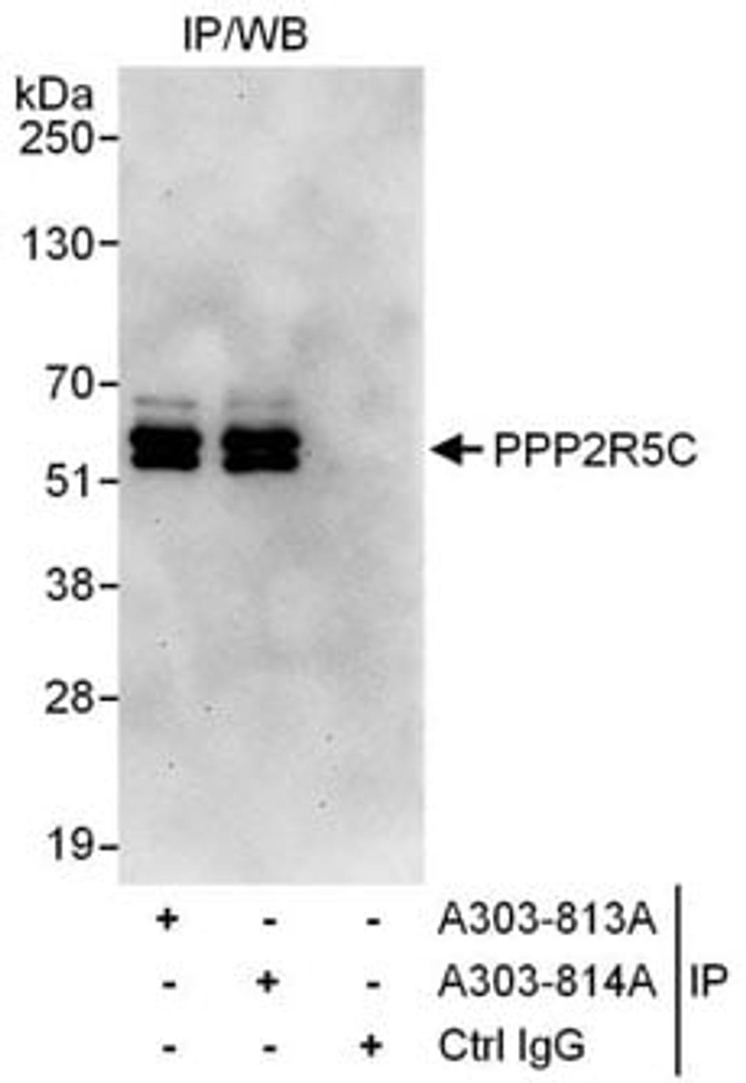 Detection of human PPP2R5C by western blot of immunoprecipitates.