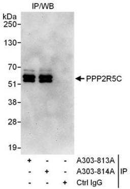 Detection of human PPP2R5C by western blot of immunoprecipitates.