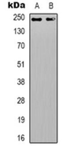 Western blot analysis of DIDO1 expression in HepG2 (Lane 1), Jurkat (Lane 2) whole cell lysates using DIDO1 antibody