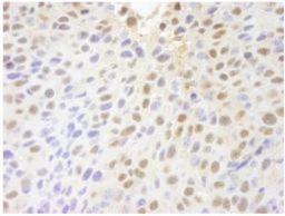 Immunohistochemistry-Paraffin: PARP10 Antibody [NB100-2157] - Section of mouse squamous cell carcinoma.