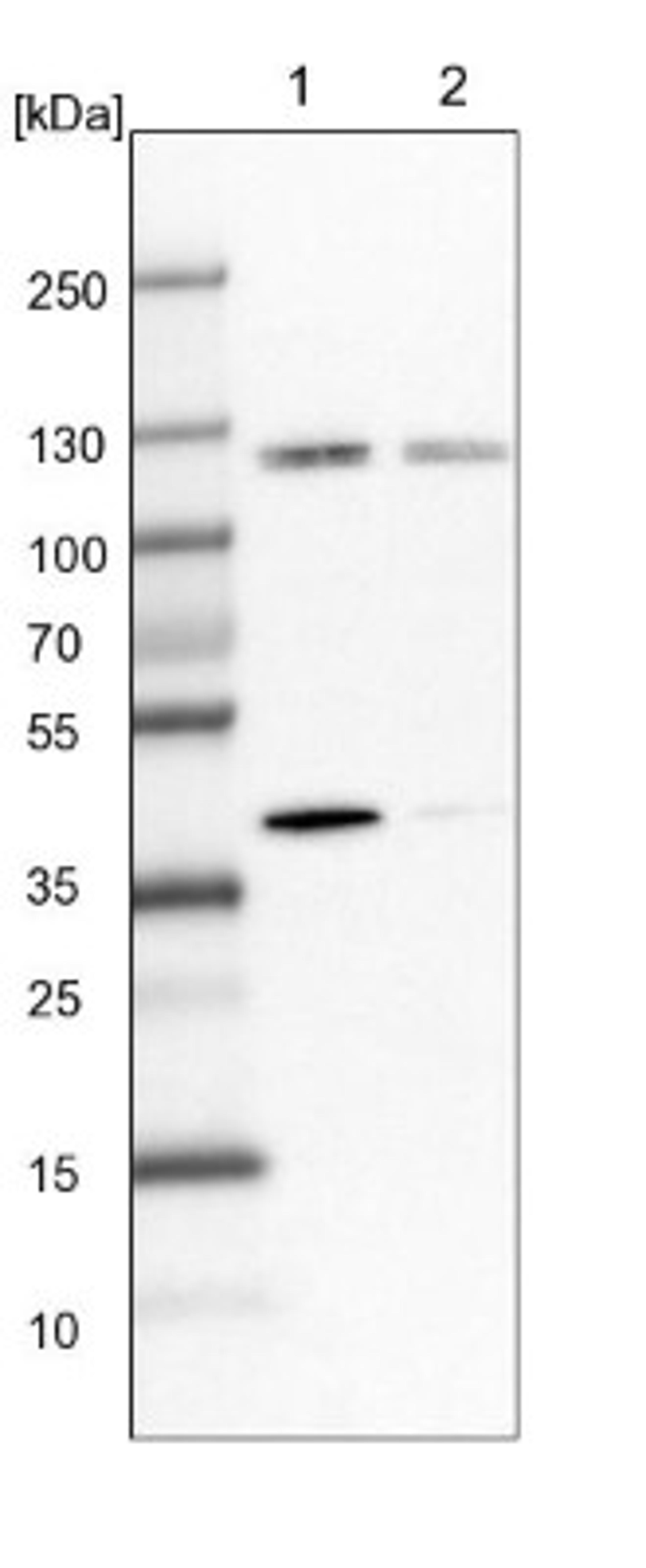 Western Blot: SH2D4B Antibody [NBP1-90896] - Lane 1: NIH-3T3 cell lysate (Mouse embryonic fibroblast cells)<br/>Lane 2: NBT-II cell lysate (Rat Wistar bladder tumour cells)