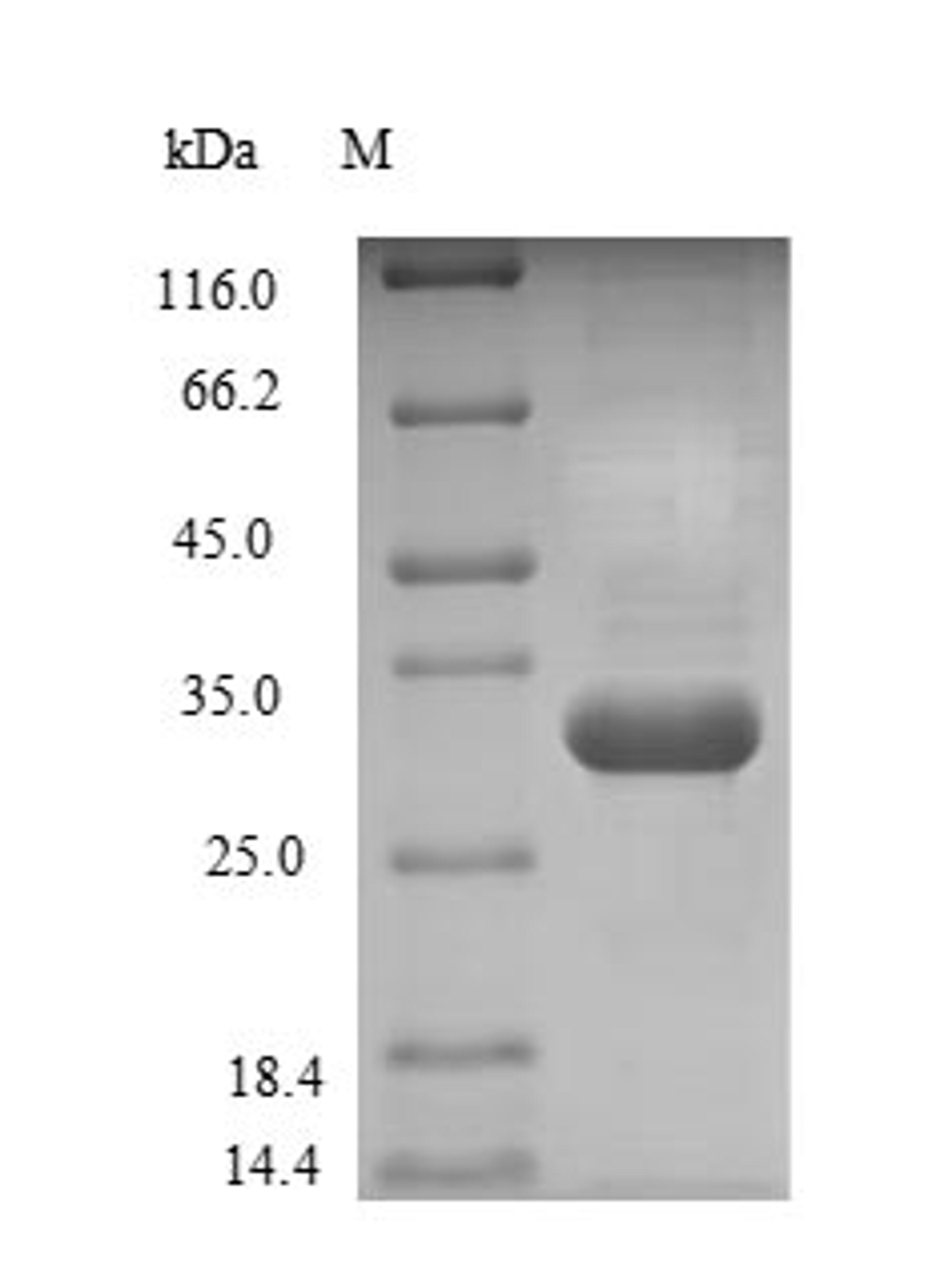 (Tris-Glycine gel) Discontinuous SDS-PAGE (reduced) with 5% enrichment gel and 15% separation gel.