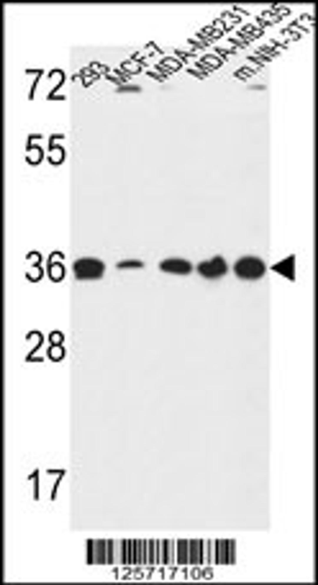 Western blot analysis in 293,MCF-7,MDA-MB231,MDA-MB435,and mouse NIH-3T3 cell line lysates (35ug/lane).