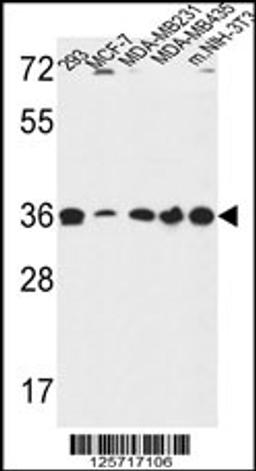 Western blot analysis in 293,MCF-7,MDA-MB231,MDA-MB435,and mouse NIH-3T3 cell line lysates (35ug/lane).