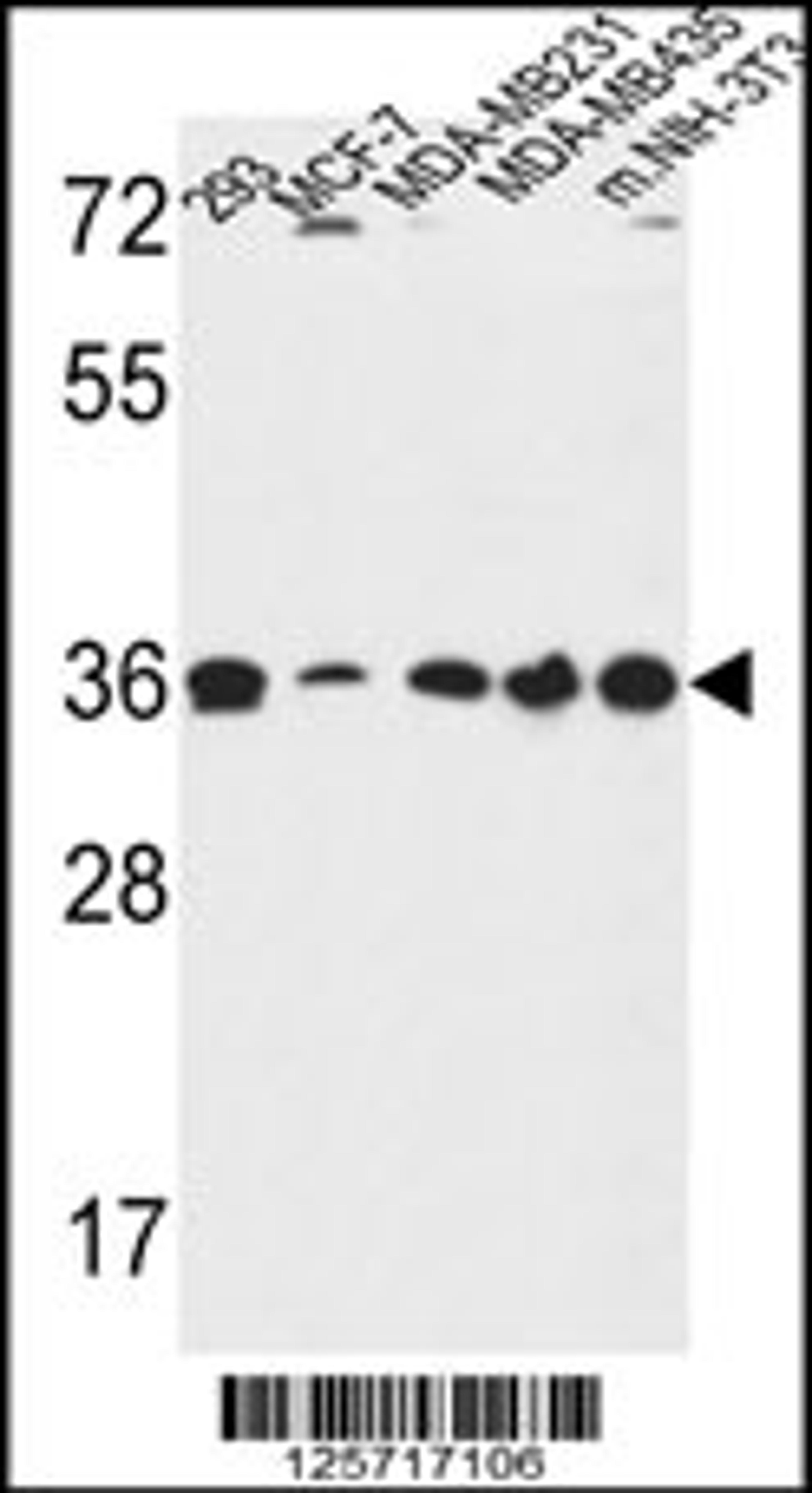 Western blot analysis in 293,MCF-7,MDA-MB231,MDA-MB435,and mouse NIH-3T3 cell line lysates (35ug/lane).