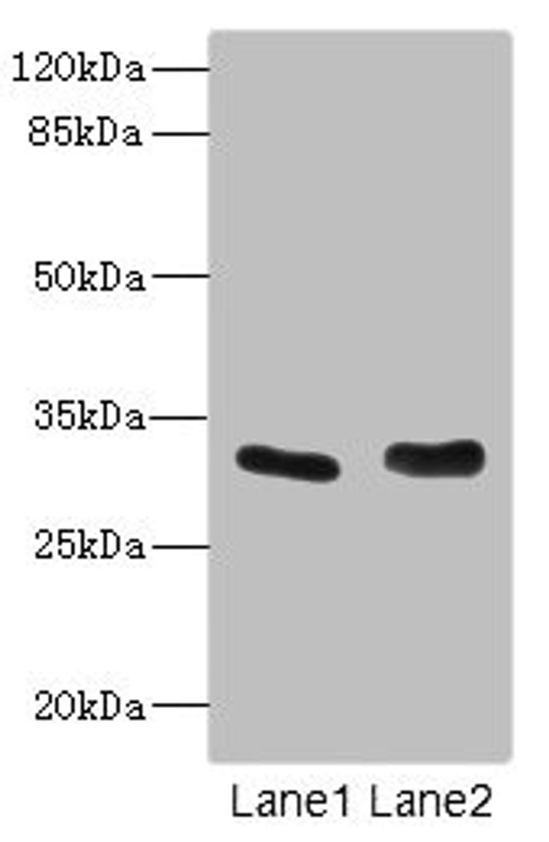 Western blot. All lanes: FHL3 antibody at 1.42ug/ml. Lane 1: Human placenta tissue. Lane 2: K562 whole cell lysate. Secondary. Goat polyclonal to rabbit IgG at 1/10000 dilution. Predicted band size: 31 kDa. Observed band size: 31 kDa.