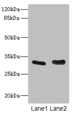Western blot. All lanes: FHL3 antibody at 1.42ug/ml. Lane 1: Human placenta tissue. Lane 2: K562 whole cell lysate. Secondary. Goat polyclonal to rabbit IgG at 1/10000 dilution. Predicted band size: 31 kDa. Observed band size: 31 kDa.
