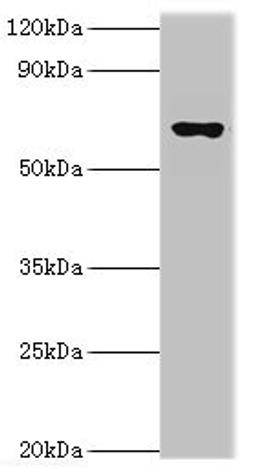 Western blot. All lanes: Glutamate decarboxylase 1 antibody at 10ug/ml + Rat brain tissue. Secondary. Goat polyclonal to rabbit IgG at 1/10000 dilution. Predicted band size: 67, 26, 48 kDa. Observed band size: 67 kDa.