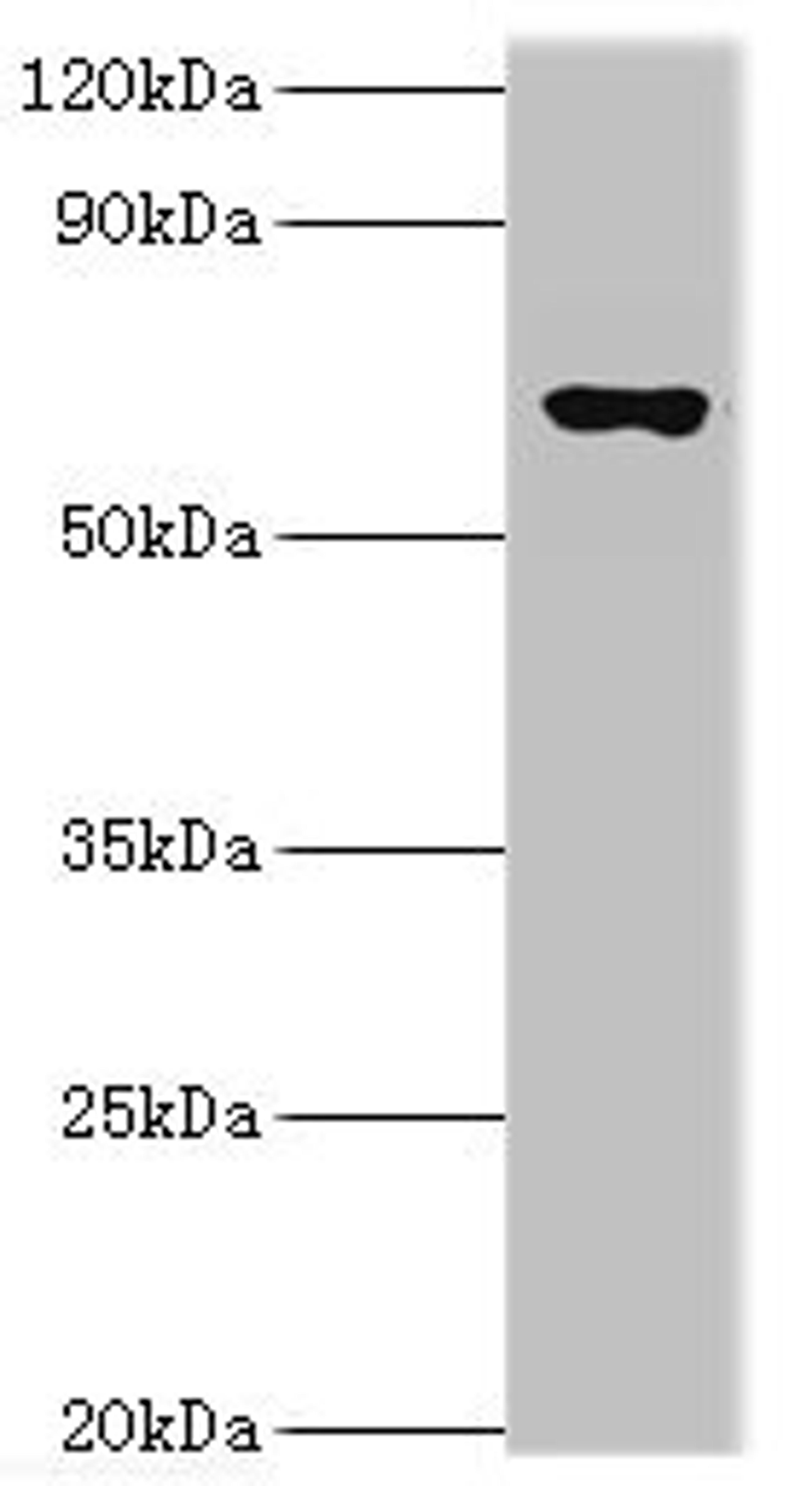 Western blot. All lanes: Glutamate decarboxylase 1 antibody at 10ug/ml + Rat brain tissue. Secondary. Goat polyclonal to rabbit IgG at 1/10000 dilution. Predicted band size: 67, 26, 48 kDa. Observed band size: 67 kDa.