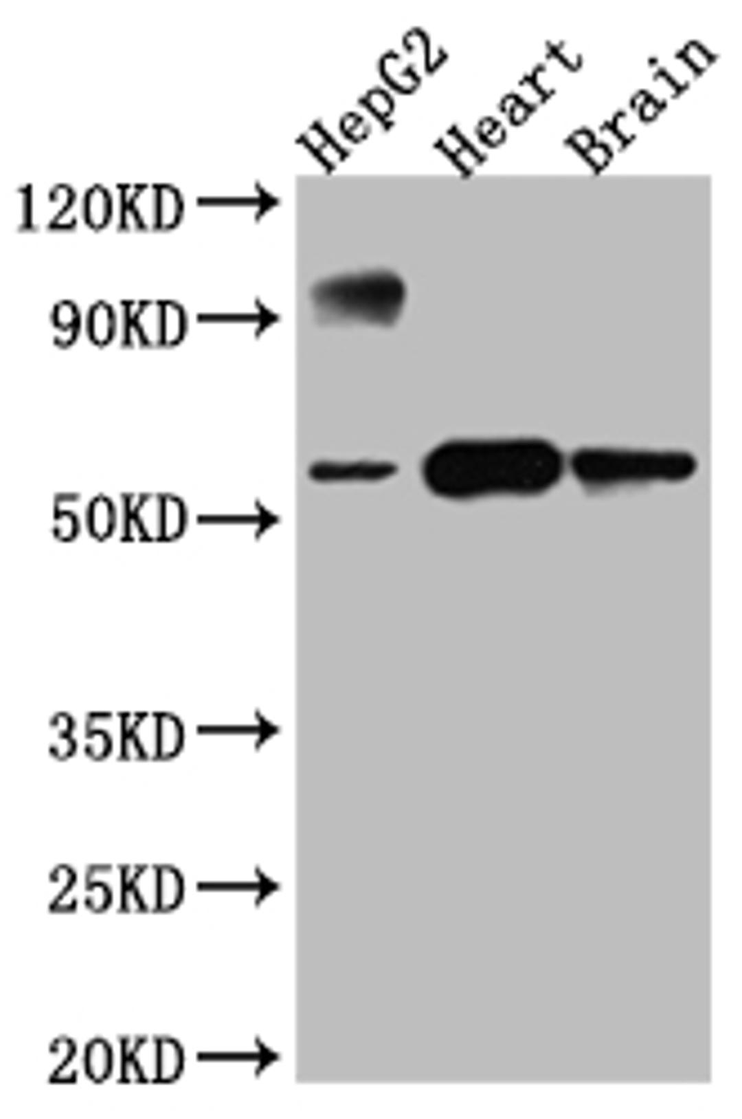 Western Blot. Positive WB detected in: HepG2 whole cell lysate, Rat Heart whole cell lysate, Rat Brain whole cell lysate. All lanes: CYP17A1 antibody at 1:1000. Secondary. Goat polyclonal to rabbit IgG at 1/50000 dilution. Predicted band size: 58 kDa. Observed band size: 58 kDa.
