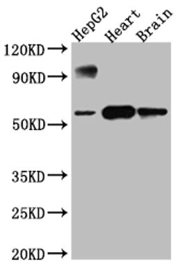 Western Blot. Positive WB detected in: HepG2 whole cell lysate, Rat Heart whole cell lysate, Rat Brain whole cell lysate. All lanes: CYP17A1 antibody at 1:1000. Secondary. Goat polyclonal to rabbit IgG at 1/50000 dilution. Predicted band size: 58 kDa. Observed band size: 58 kDa.