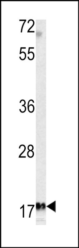 Western blot analysis of MFAP5 antibody in K562 cell line lysates (35ug/lane)