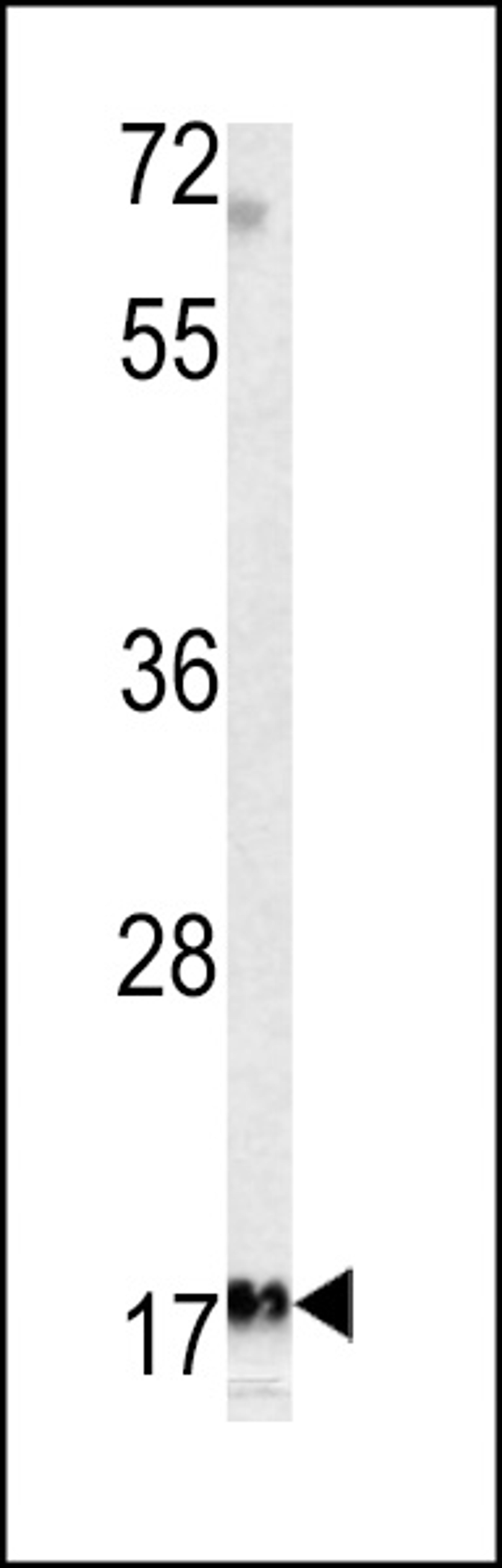 Western blot analysis of MFAP5 antibody in K562 cell line lysates (35ug/lane)