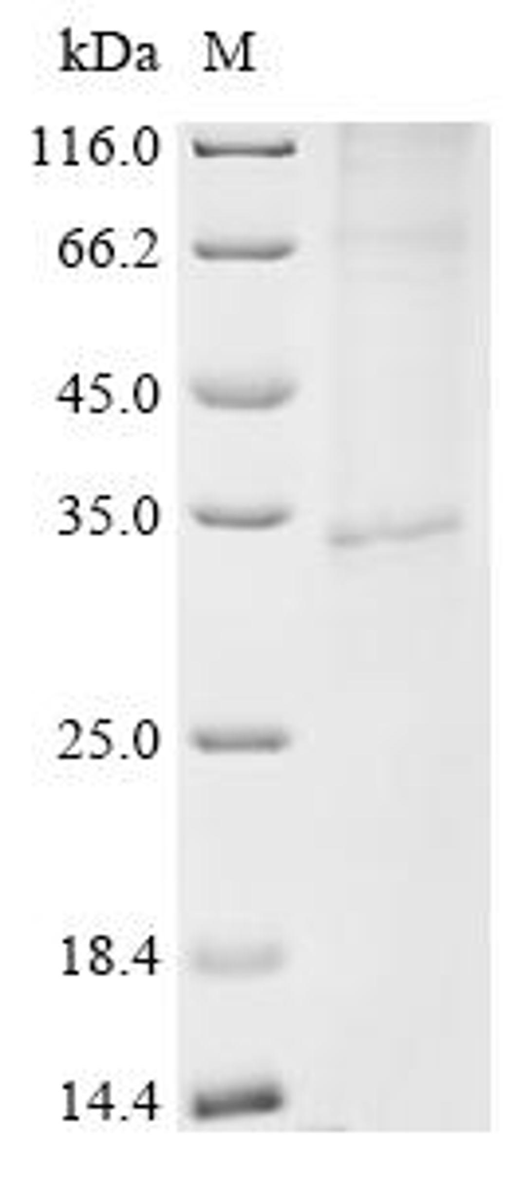 (Tris-Glycine gel) Discontinuous SDS-PAGE (reduced) with 5% enrichment gel and 15% separation gel.