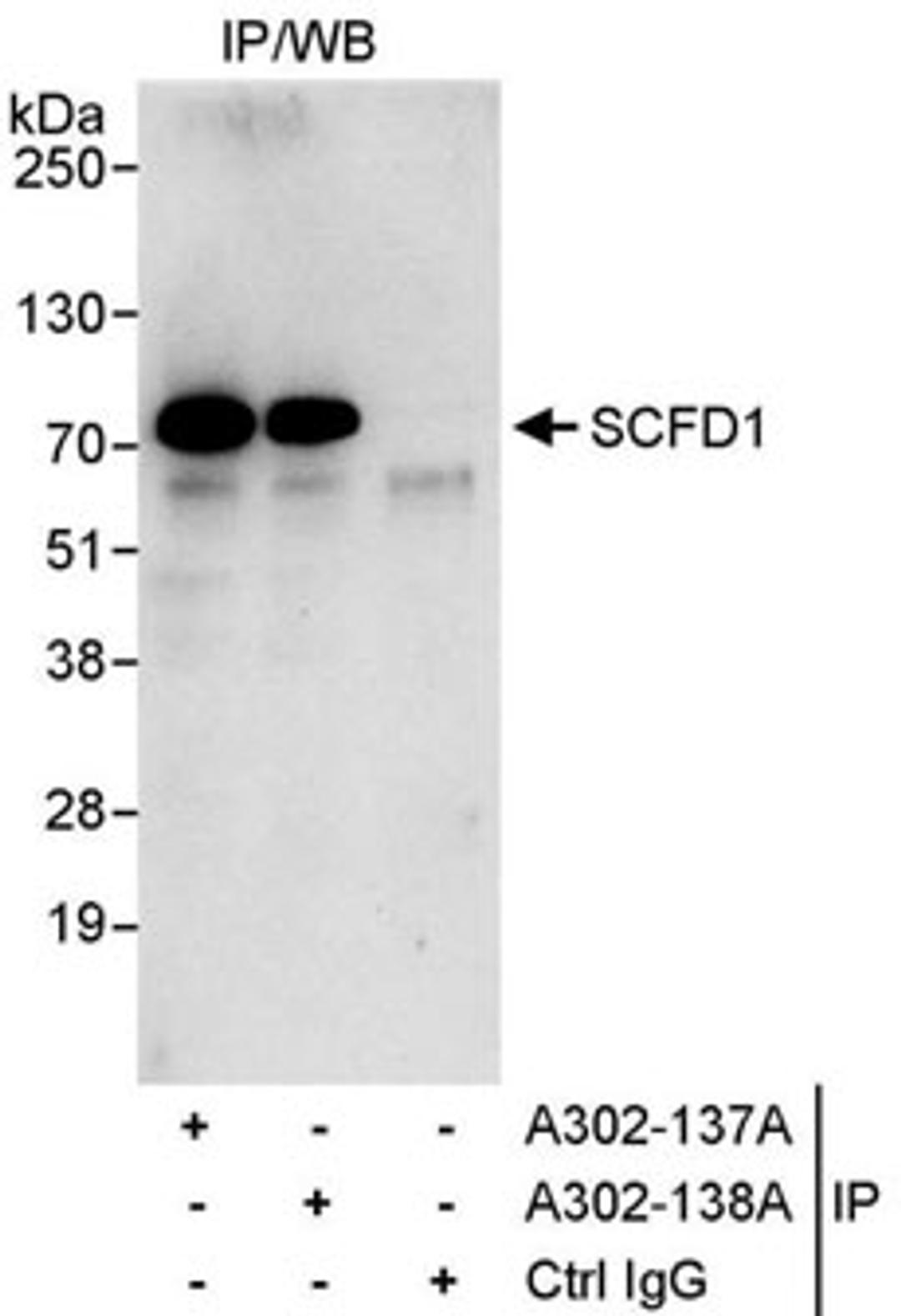 Detection of human SCFD1 by western blot of immunoprecipitates.