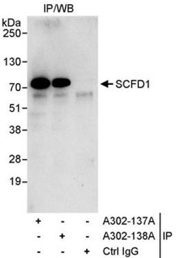 Detection of human SCFD1 by western blot of immunoprecipitates.