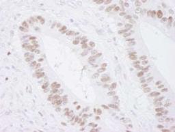 Detection of human MCM3 by immunohistochemistry.