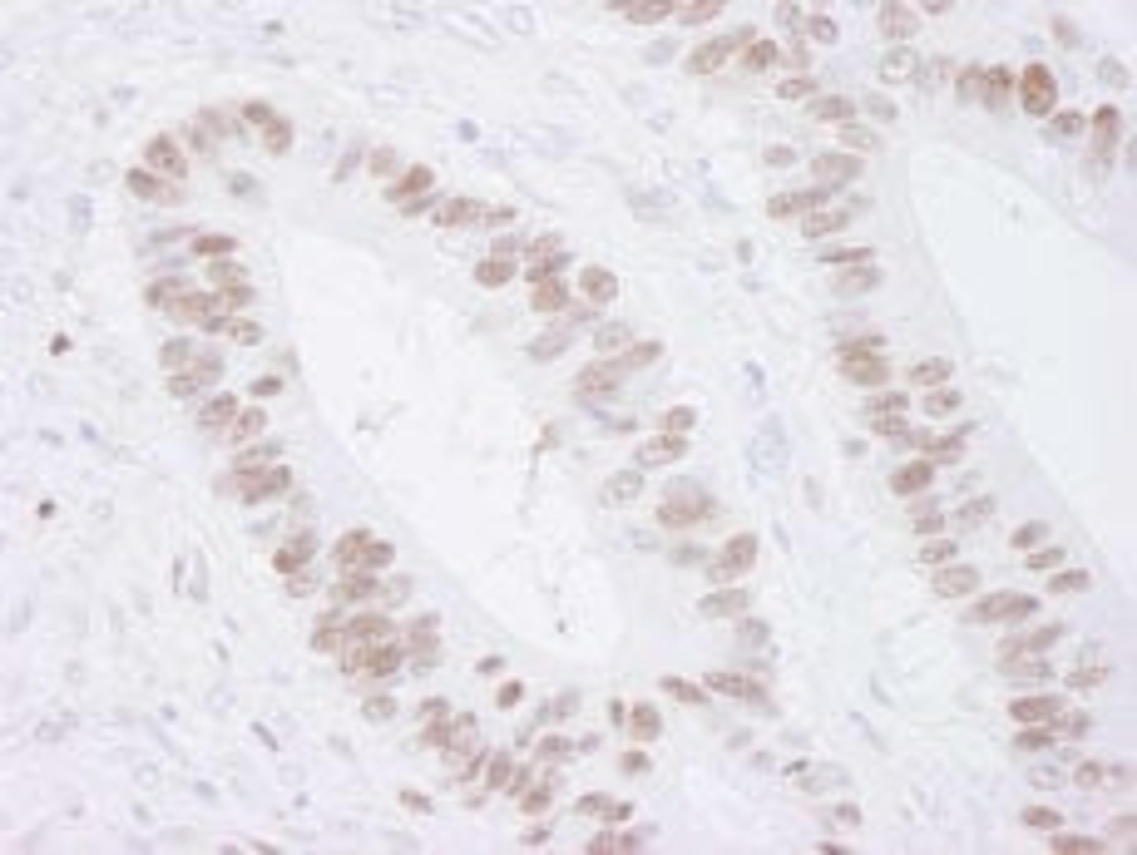 Detection of human MCM3 by immunohistochemistry.