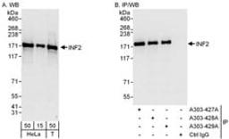 Detection of human INF2 by western blot and immunoprecipitation.