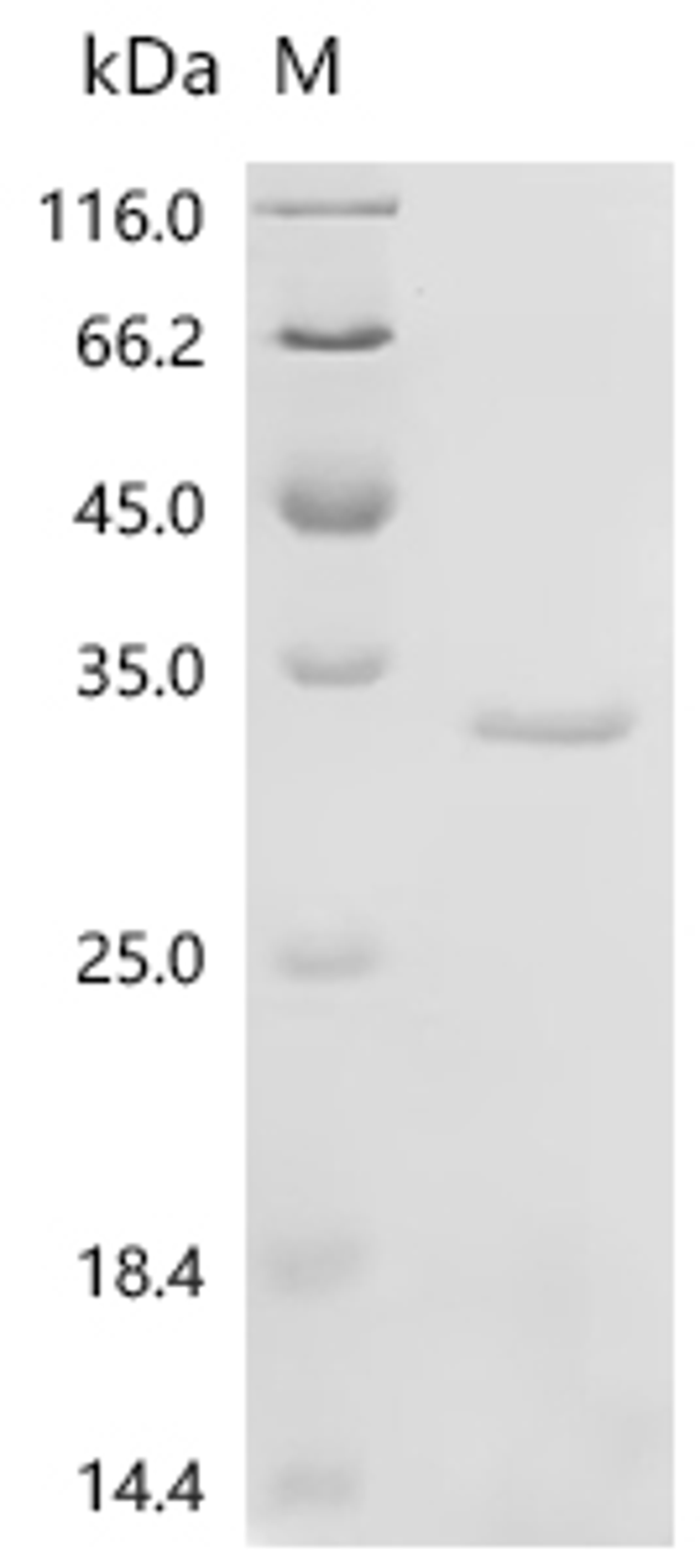 (Tris-Glycine gel) Discontinuous SDS-PAGE (reduced) with 5% enrichment gel and 15% separation gel.