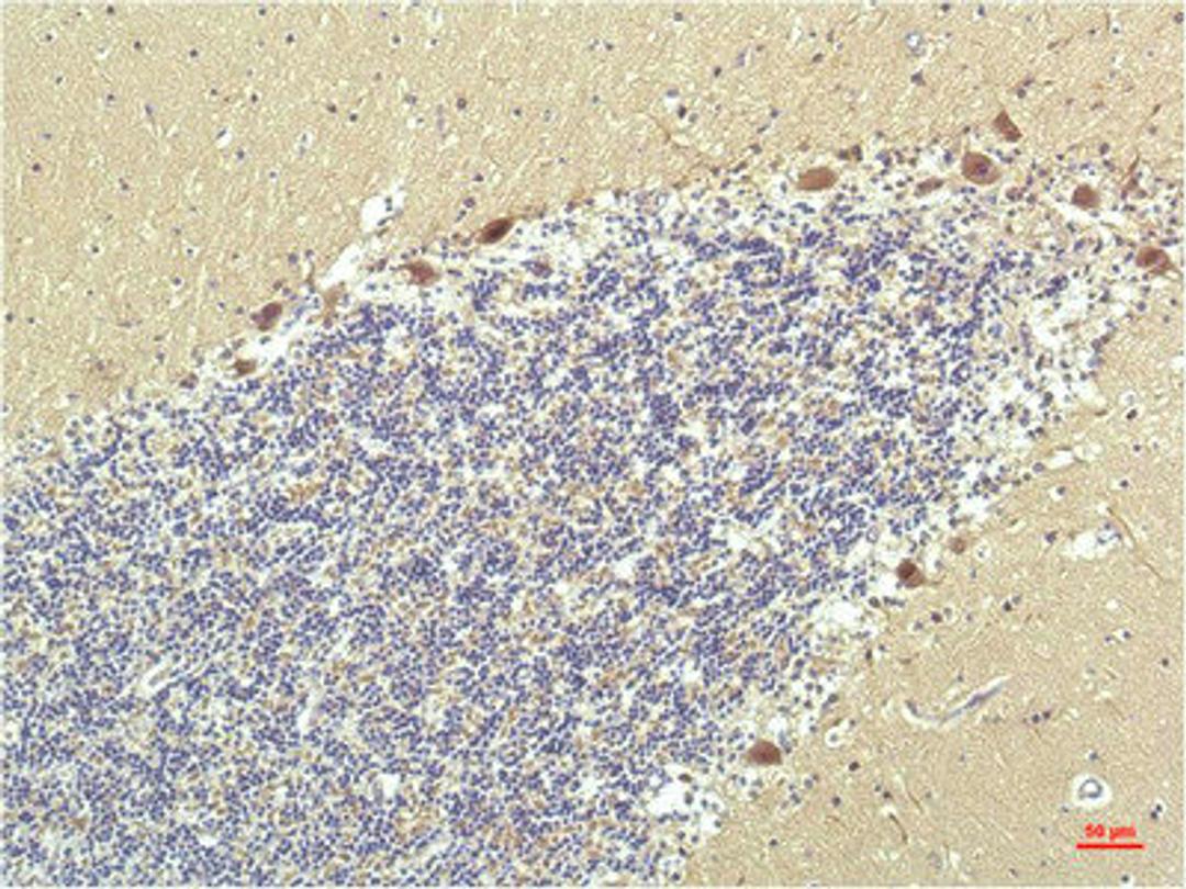 Immunohistochemical analysis of paraffin-embedded Human Brain Tissue using PPAR Delta Mouse mAb diluted at 1:200.