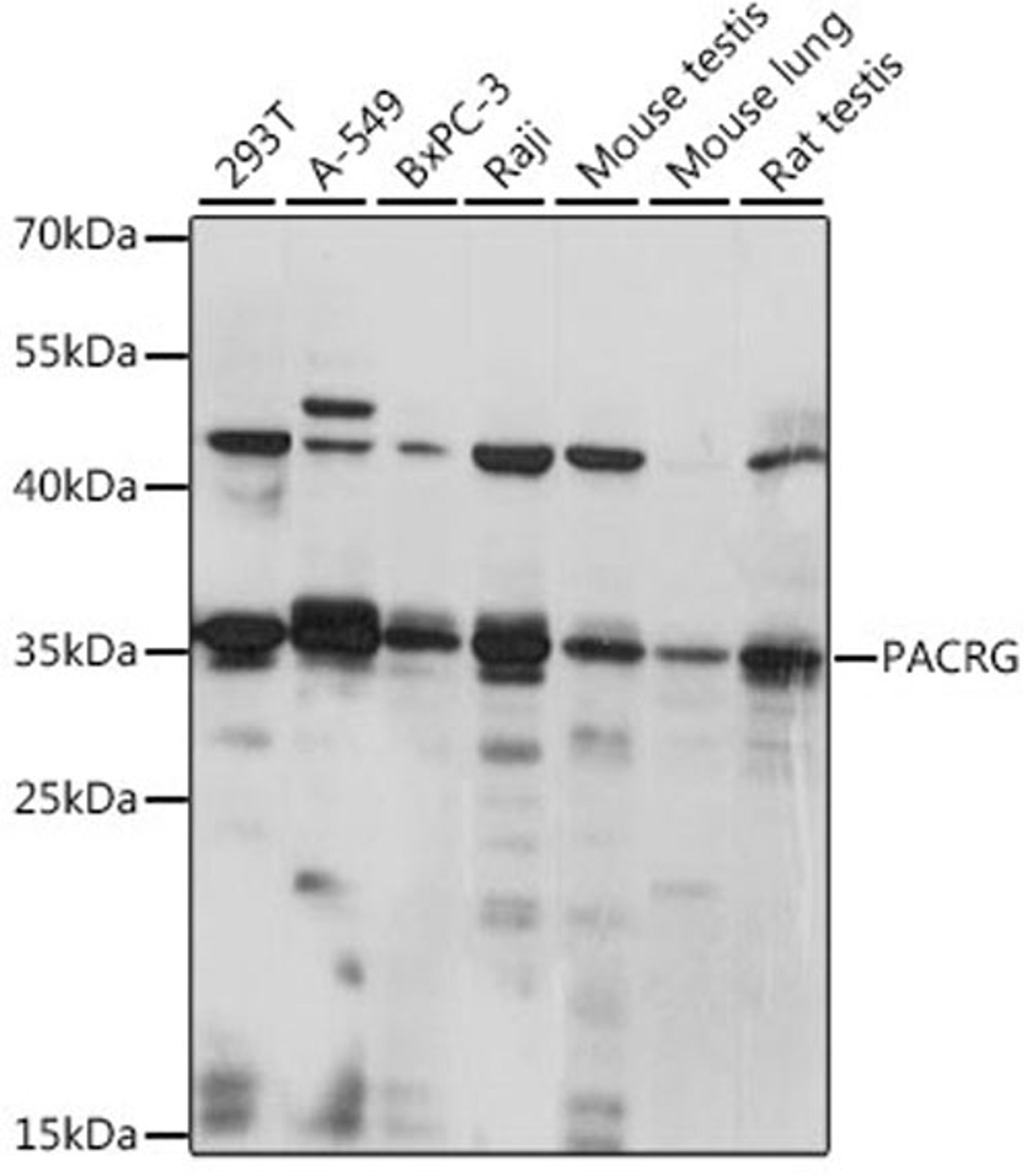 Western blot - PACRG antibody (A15956)