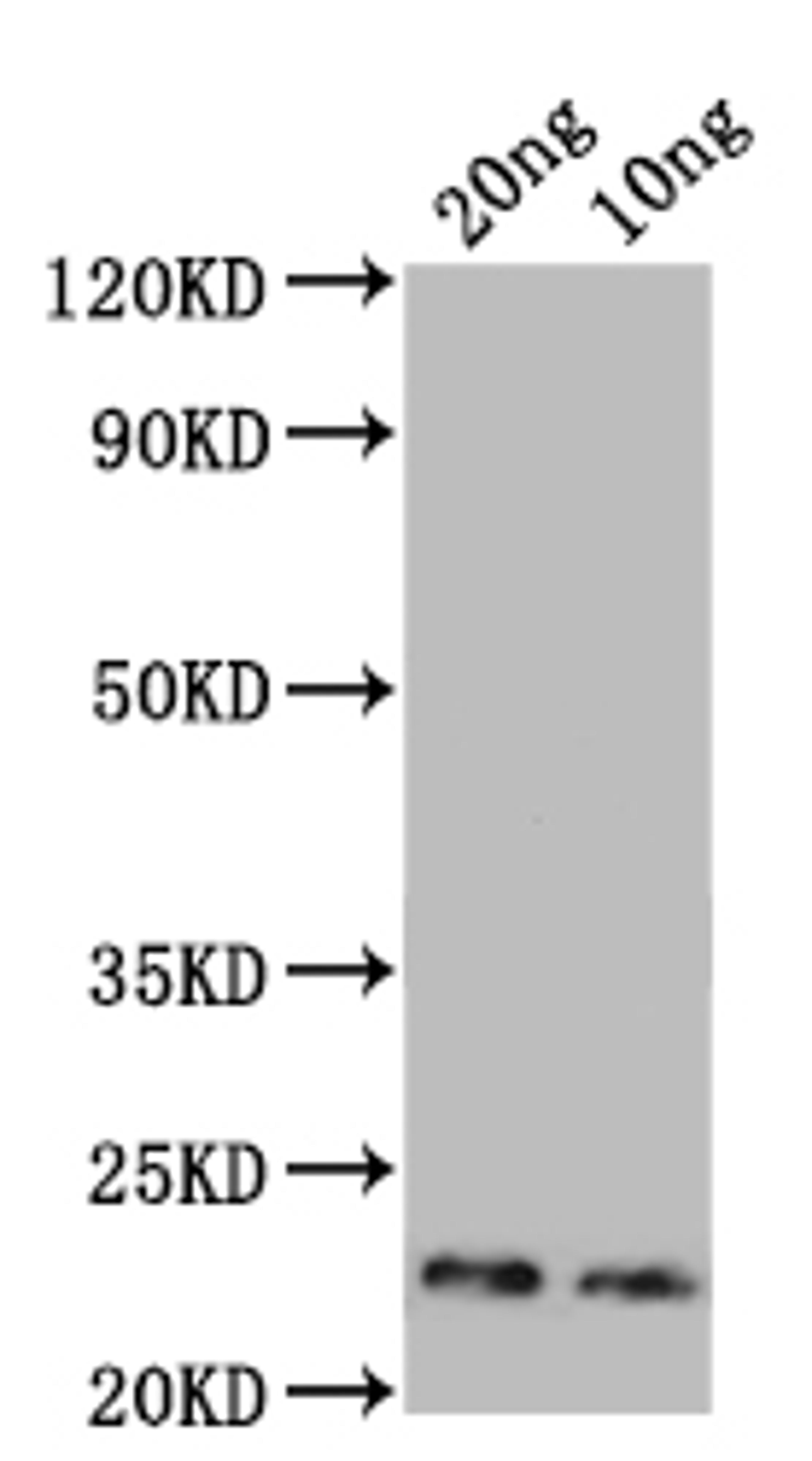 Western Blot. Positive WB detected in: recombinant protein. All lanes: Major mite allergen Der p 23 Antibody at 1:1000. Secondary. Goat polyclonal to rabbit IgG at 1/50000 dilution. Predicted band size: 20 kDa. Observed band size: 23 kDa.