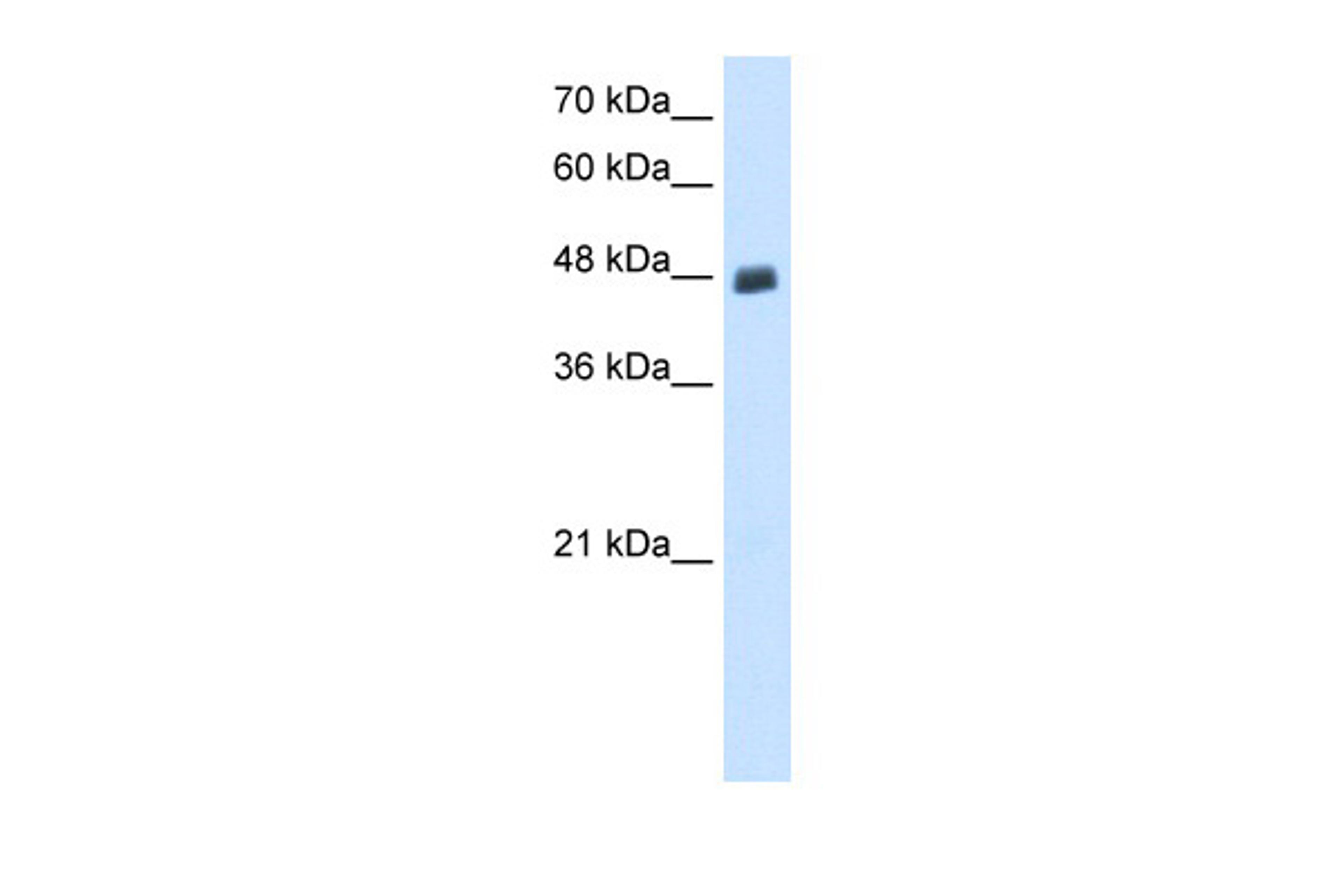 Antibody used in WB on Transfected 293T at 0.2-1 ug/ml.