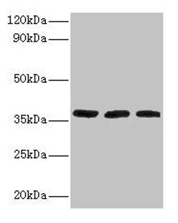 Western blot. All lanes: FTSJ1 antibody at 2µg/ml. Lane 1: HepG2 whole cell lysate. Lane 2: Mouse brain tissue. Lane 3: EC109 whole cell lysate. Secondary. Goat polyclonal to rabbit IgG at 1/15000 dilution. Predicted band size: 37, 36 kDa. Observed band size: 37 kDa