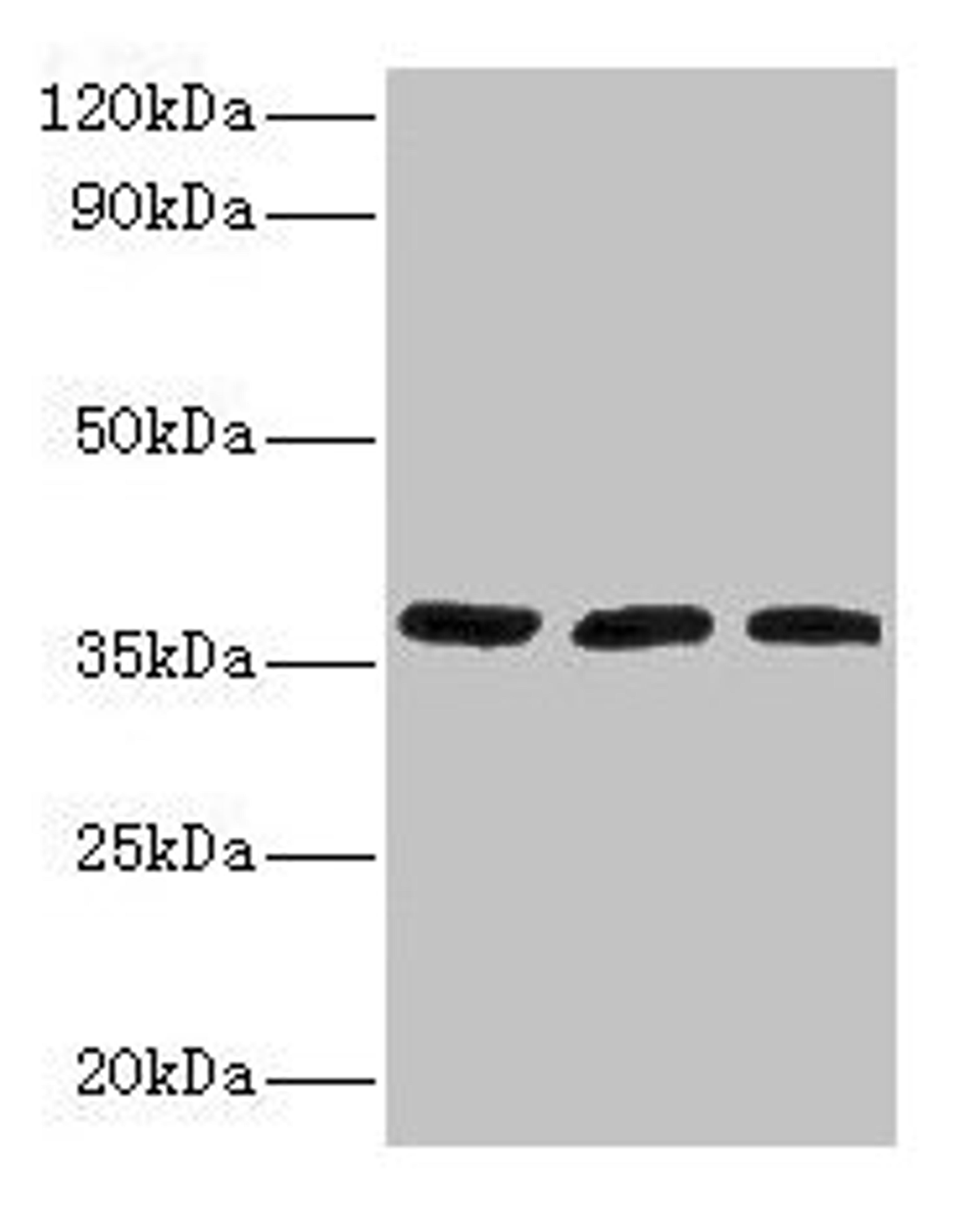 Western blot. All lanes: FTSJ1 antibody at 2µg/ml. Lane 1: HepG2 whole cell lysate. Lane 2: Mouse brain tissue. Lane 3: EC109 whole cell lysate. Secondary. Goat polyclonal to rabbit IgG at 1/15000 dilution. Predicted band size: 37, 36 kDa. Observed band size: 37 kDa