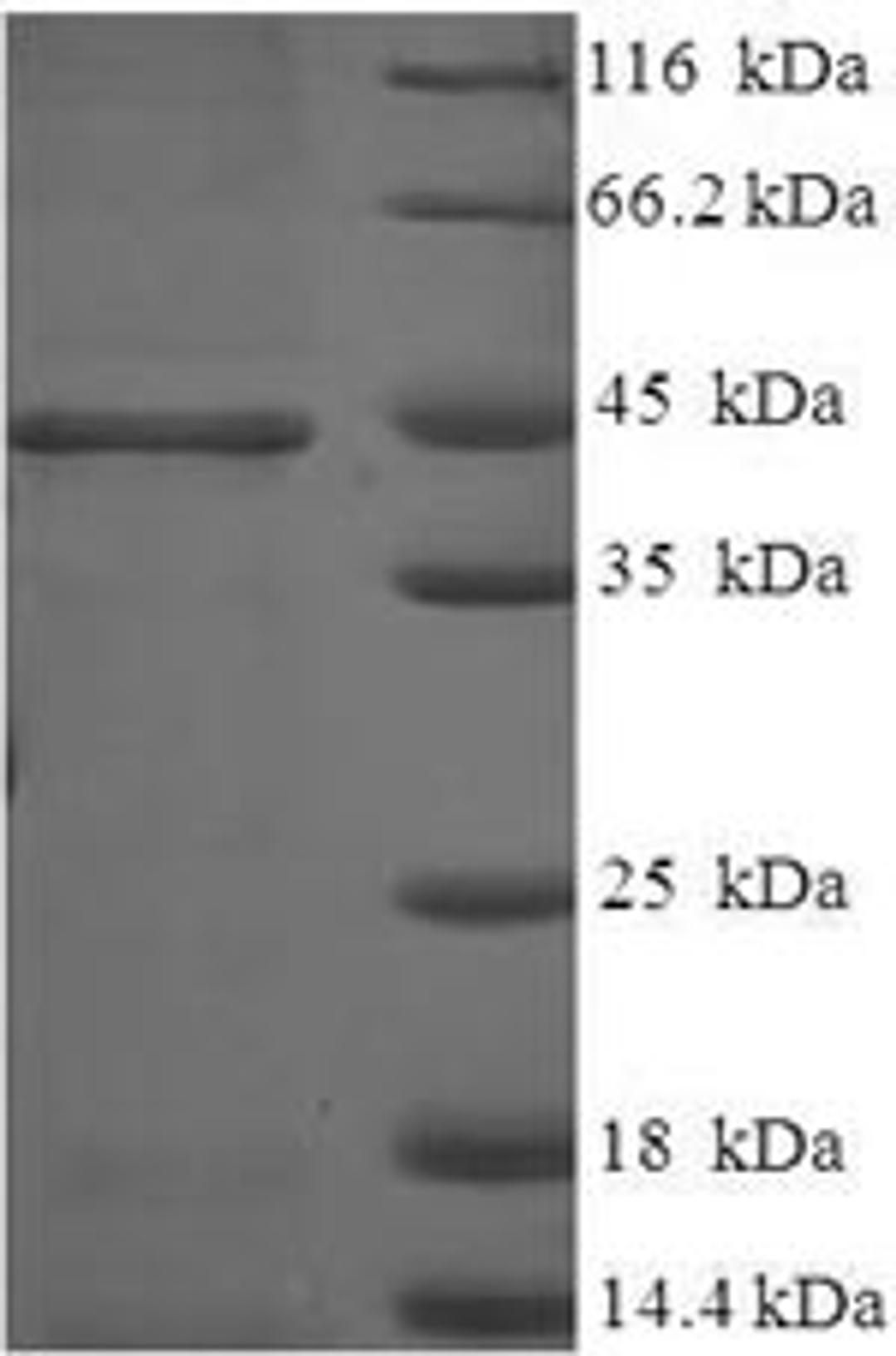 (Tris-Glycine gel) Discontinuous SDS-PAGE (reduced) with 5% enrichment gel and 15% separation gel.