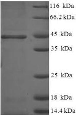 (Tris-Glycine gel) Discontinuous SDS-PAGE (reduced) with 5% enrichment gel and 15% separation gel.