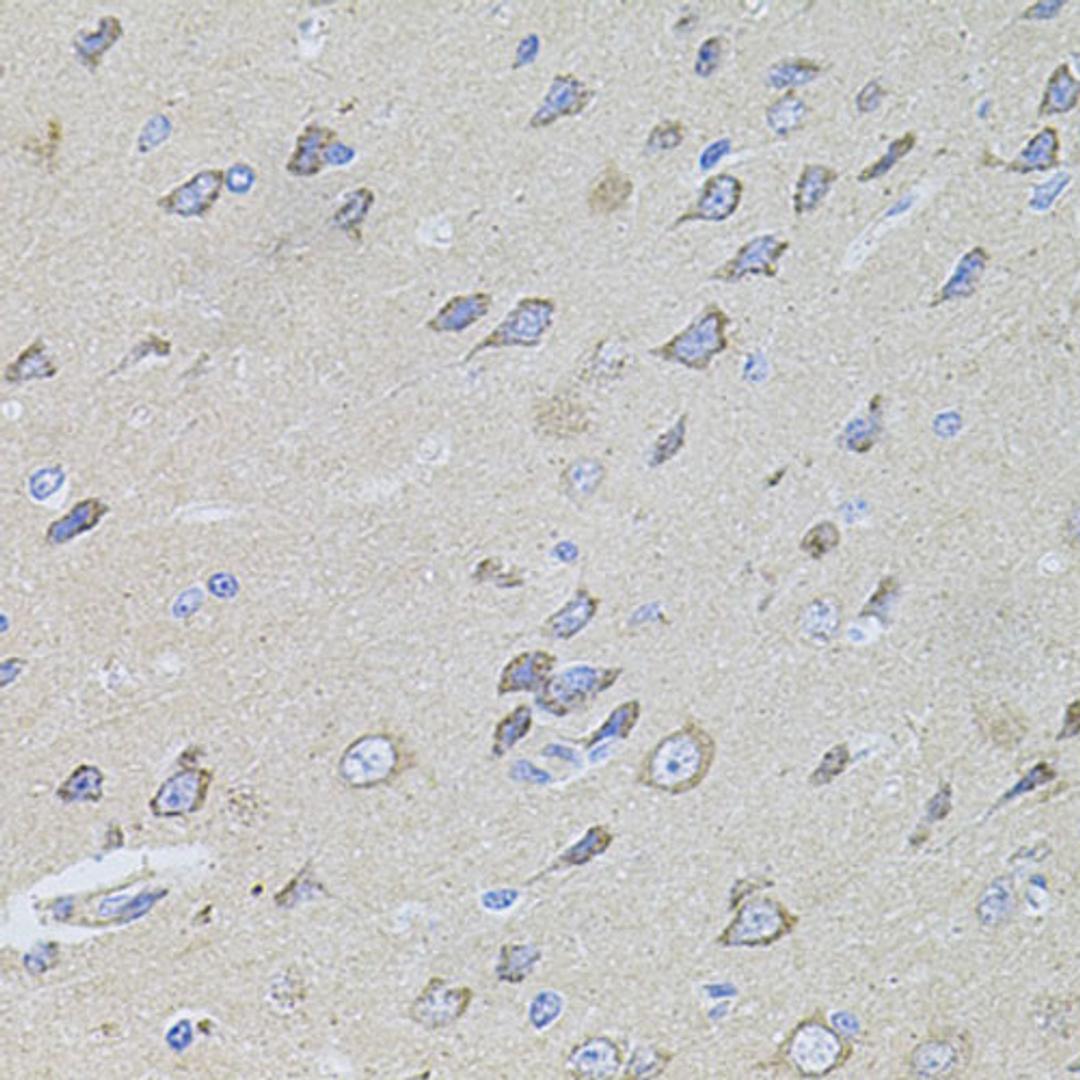 Immunohistochemistry  - WISP2 antibody (A12541)