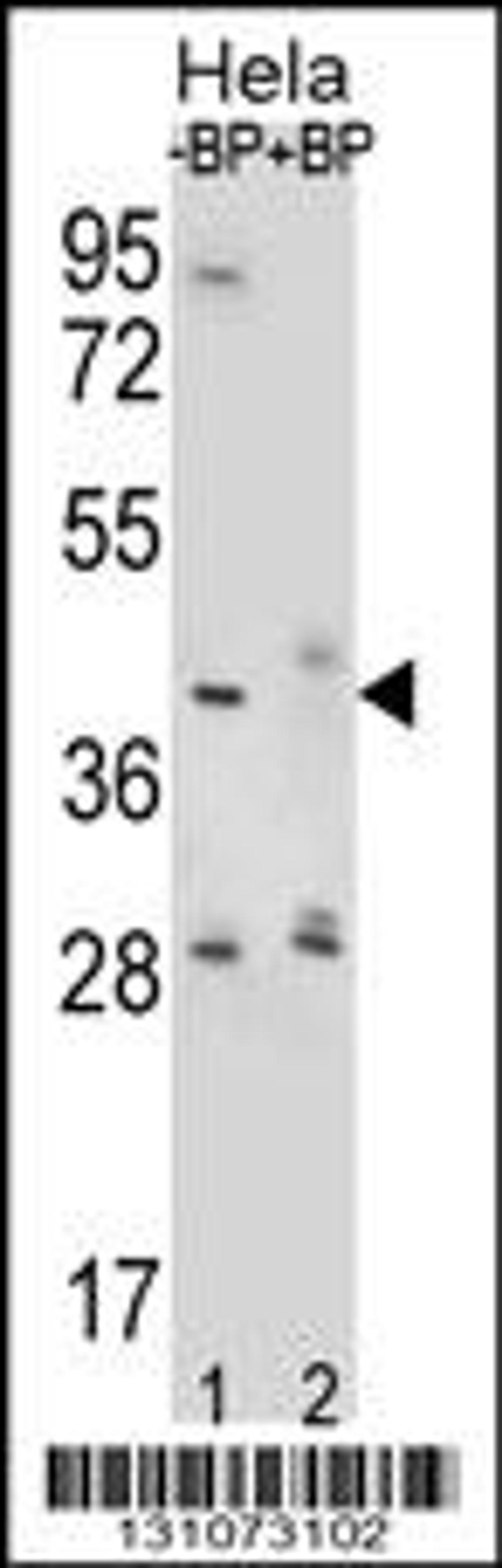 Western blot analysis of HYAL2 Antibody Pab pre-incubated without(lane 1) and with(lane 2) blocking peptide in Hela cell line lysate.