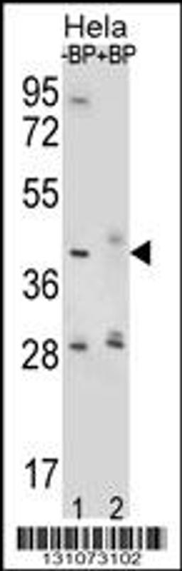 Western blot analysis of HYAL2 Antibody Pab pre-incubated without(lane 1) and with(lane 2) blocking peptide in Hela cell line lysate.