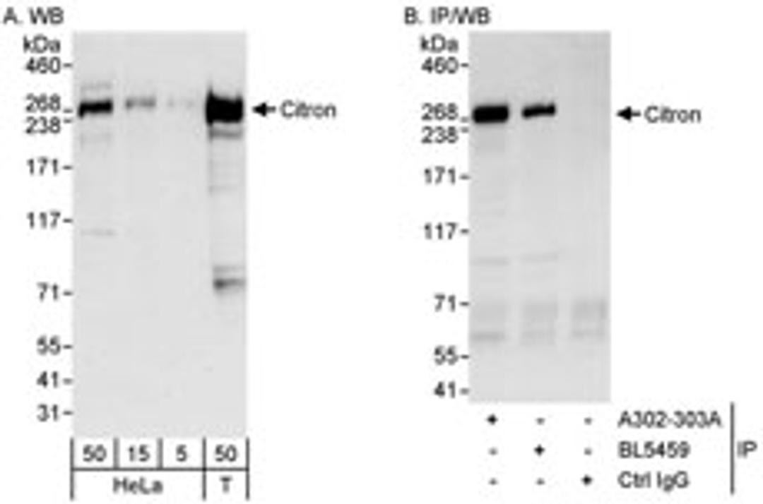 Detection of human Citron by western blot and immunoprecipitation.