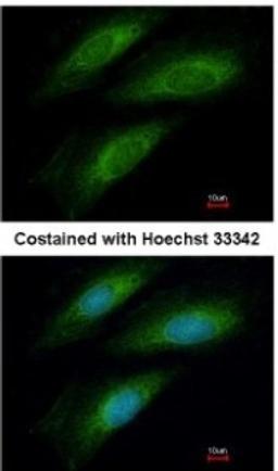 Immunocytochemistry/Immunofluorescence: ISCU Antibody [NBP2-14998] - Analysis of methanol-fixed HeLa, using antibody at 1:200 dilution.